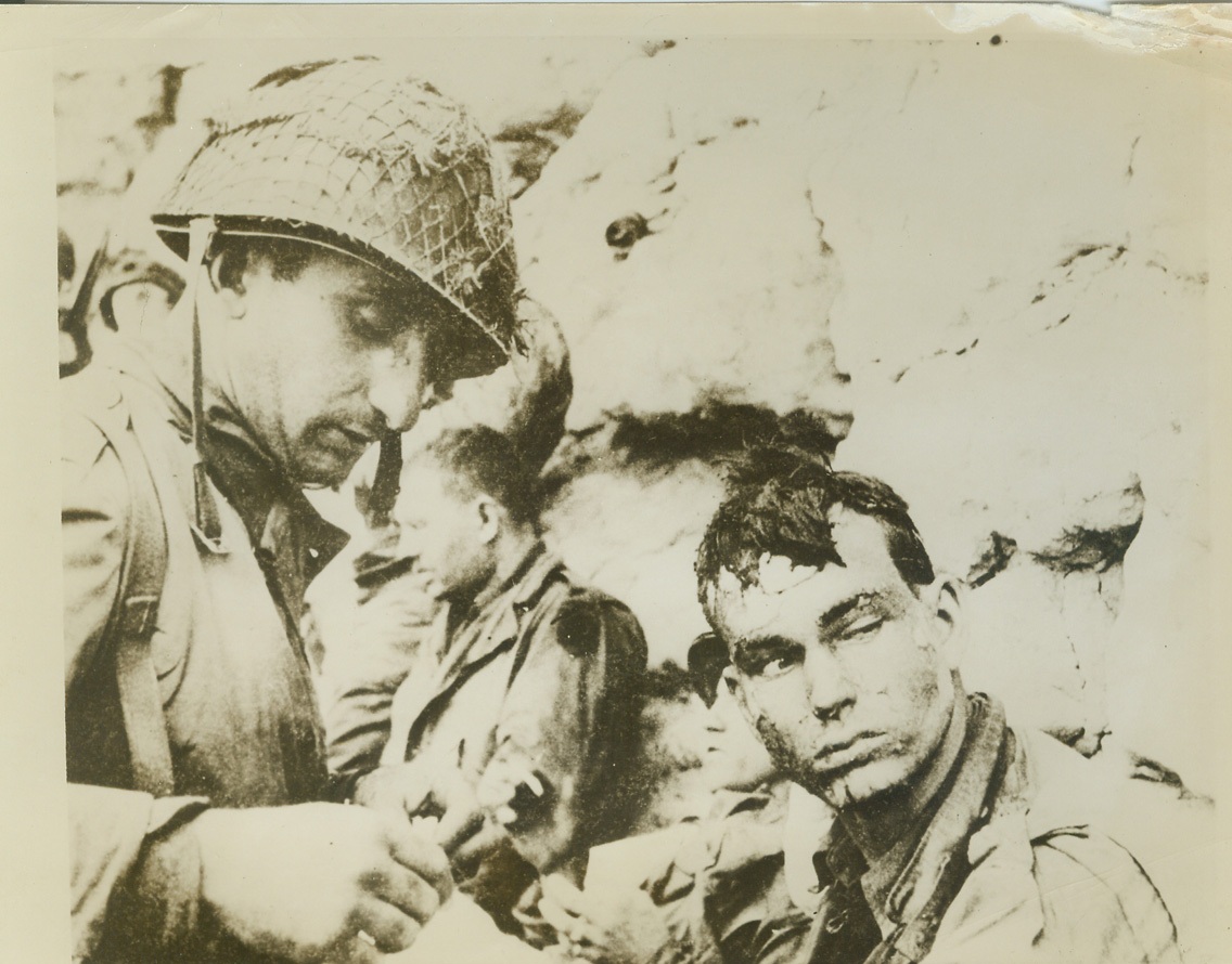 U.S. Invasion Casualty, 6/13/1944. France – His head battered, his face streaked with sweat and dirt, and his eyes mirroring the horror he has seen, an American soldier (right), keeps watching the battle down the beach as his hand is bandaged by a medical corpsman. He was one of the U.S. casualties during the early landings along the coast of France. Credit: (ACME);