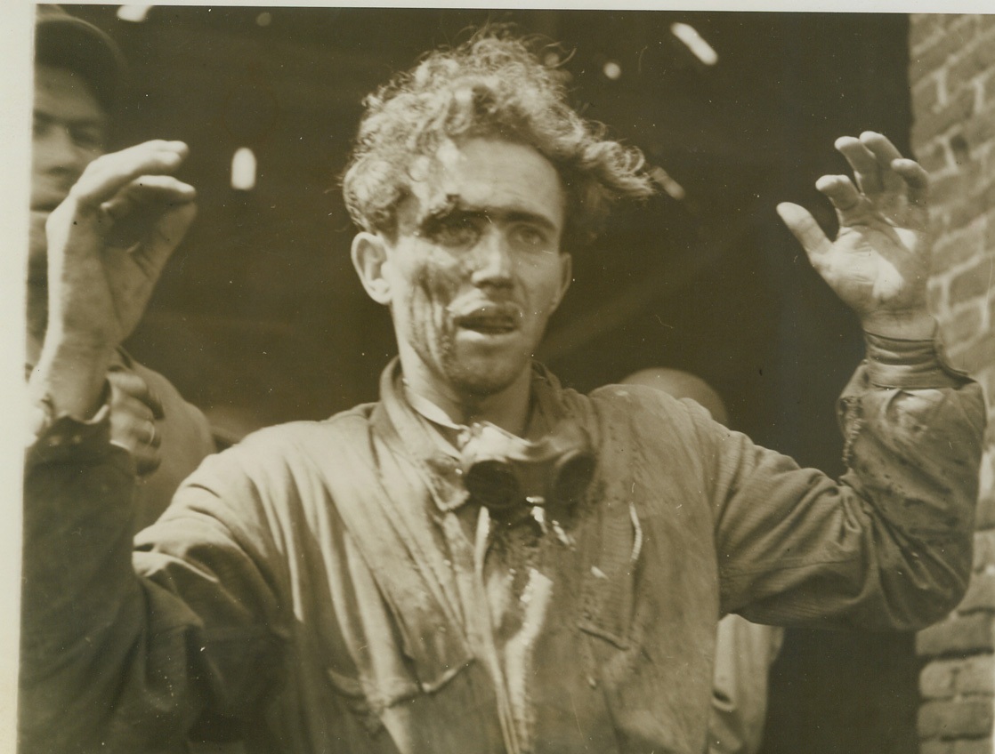 “Uncle!”, 9/10/1944. Maubeuge, France – Wounded in the fight for Maubeuge, on the Franco-Belgian border, this superman threw up his hands and cried “Uncle” in no uncertain terms. Looks like the little man has had a rough day. Photo by Andy Lopez, ACME Photographer for the War Picture Pool. Credit: –WP – (ACME);